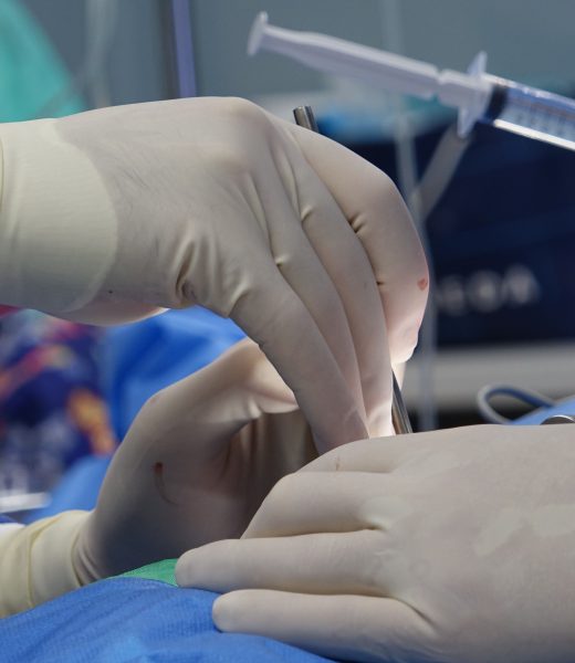 Quelle est vraiment la taille d&rsquo;une aiguille de péridurale ?