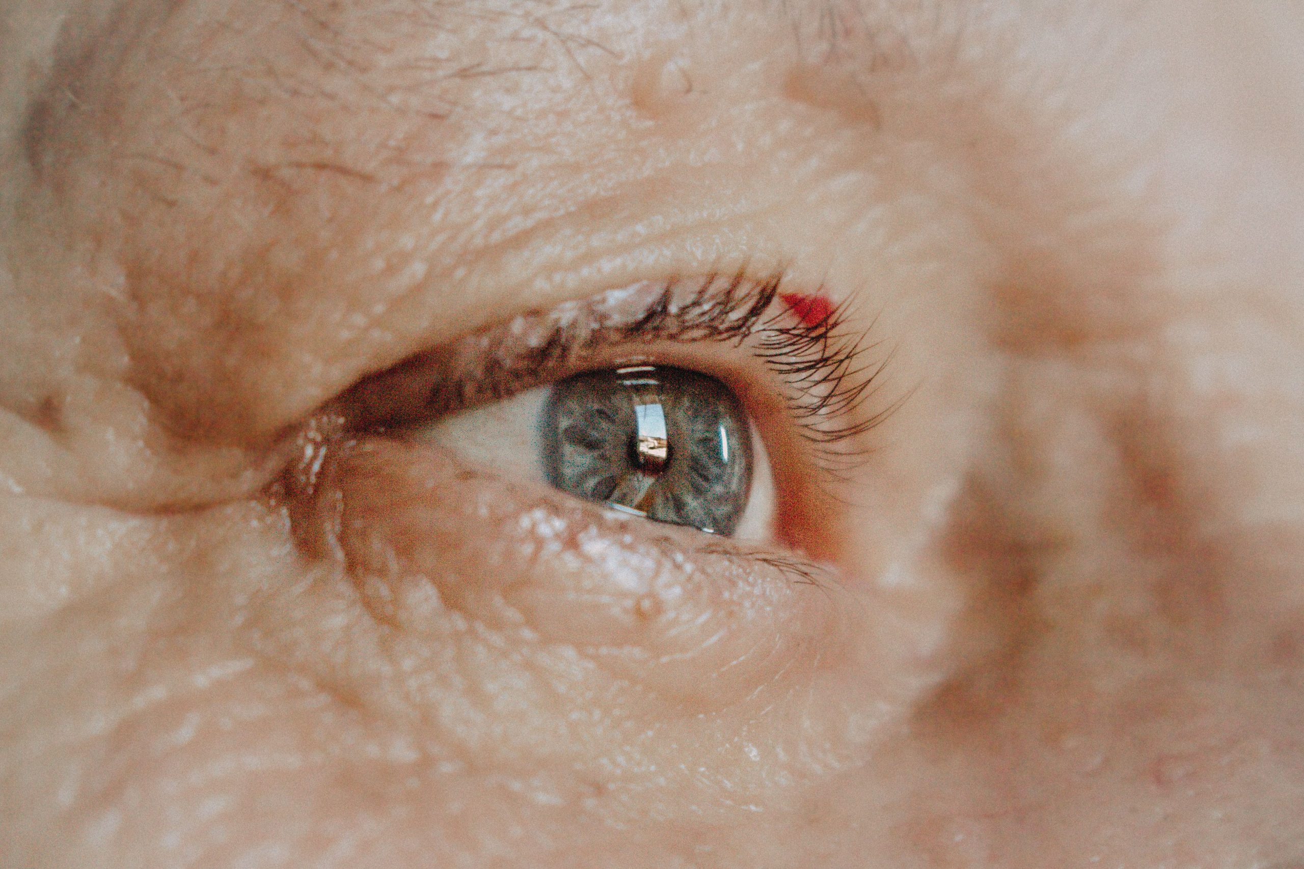 Comment voit on avec une cataracte au quotidien ?