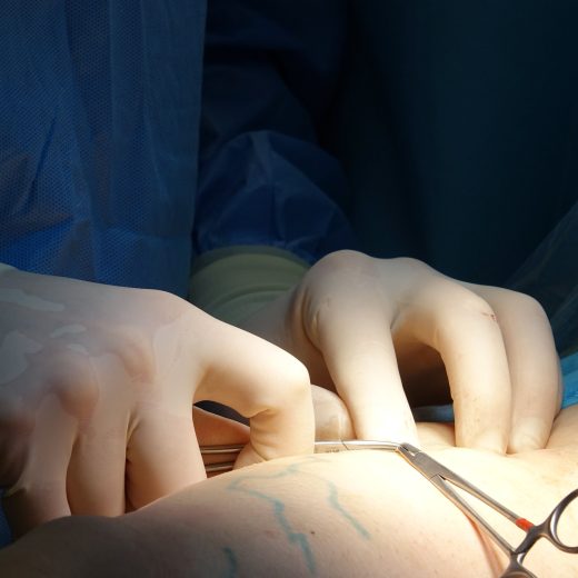 C&rsquo;est quoi une vasectomie, concrètement et sans tabou ?