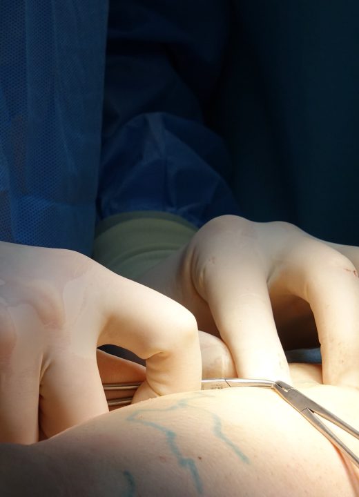C&rsquo;est quoi une vasectomie, concrètement et sans tabou ?